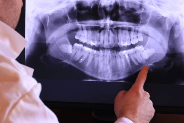 Best Emergency Root Canal Treatment in Palm Shores, FL
