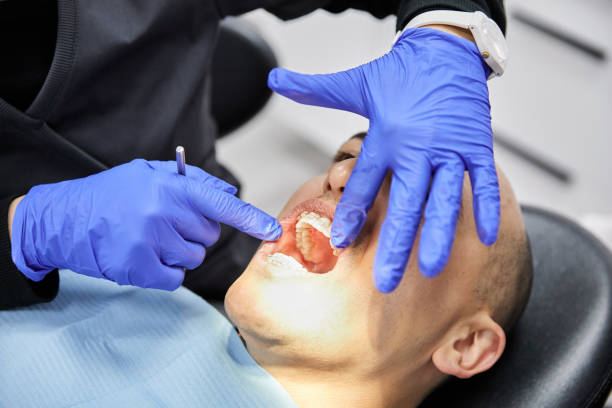Best Same-Day Emergency Dentist in Palm Shores, FL